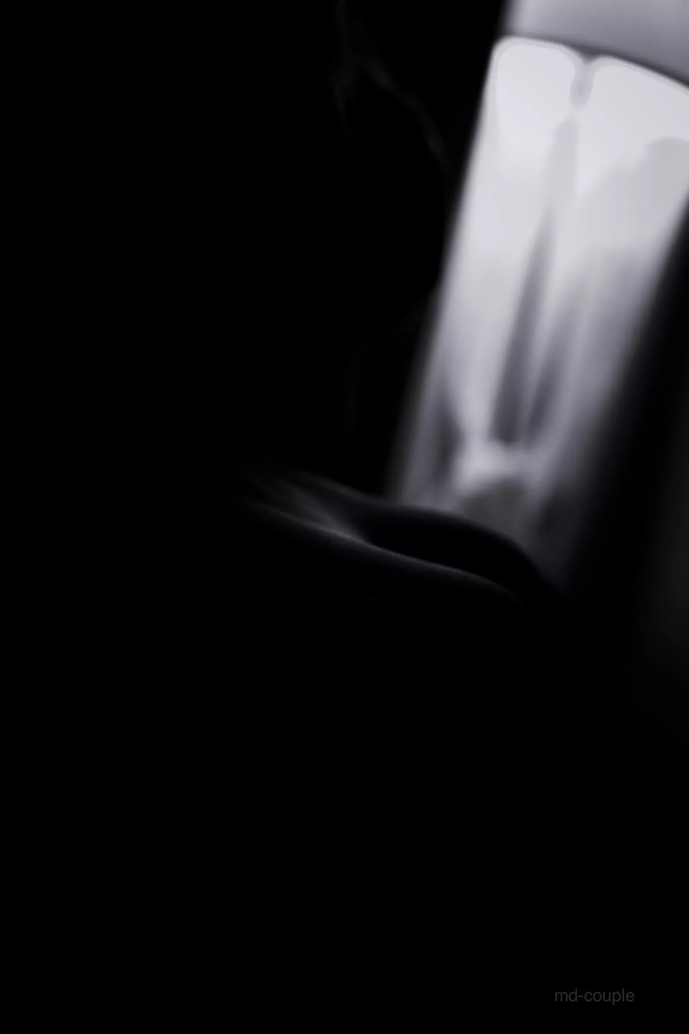 decolletage