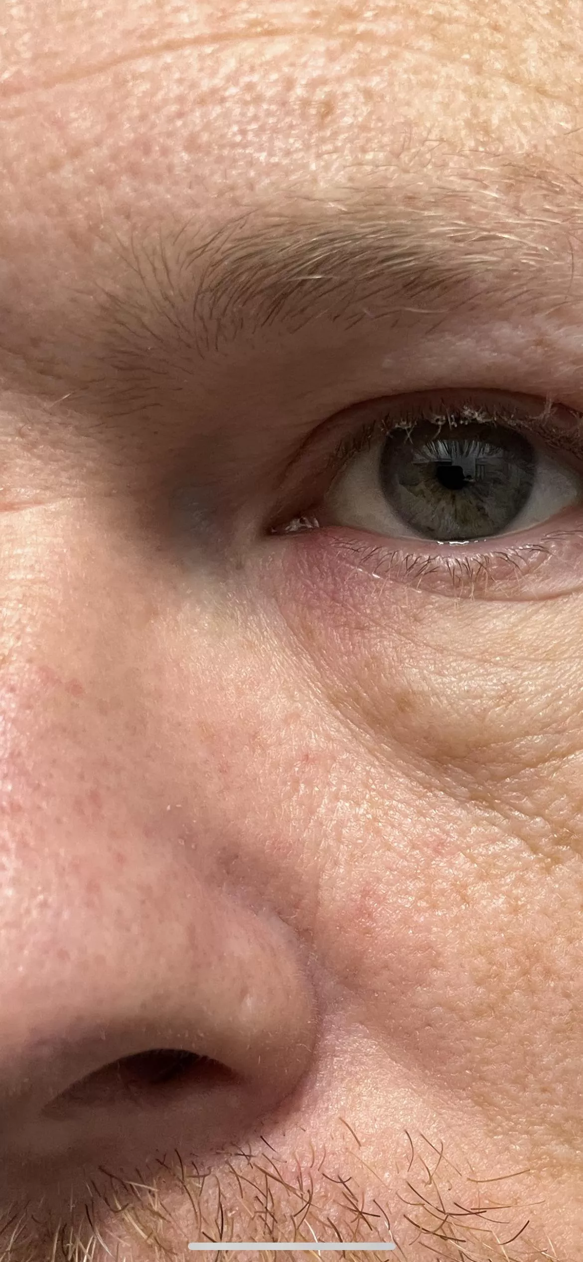 Incoming forbidden pop