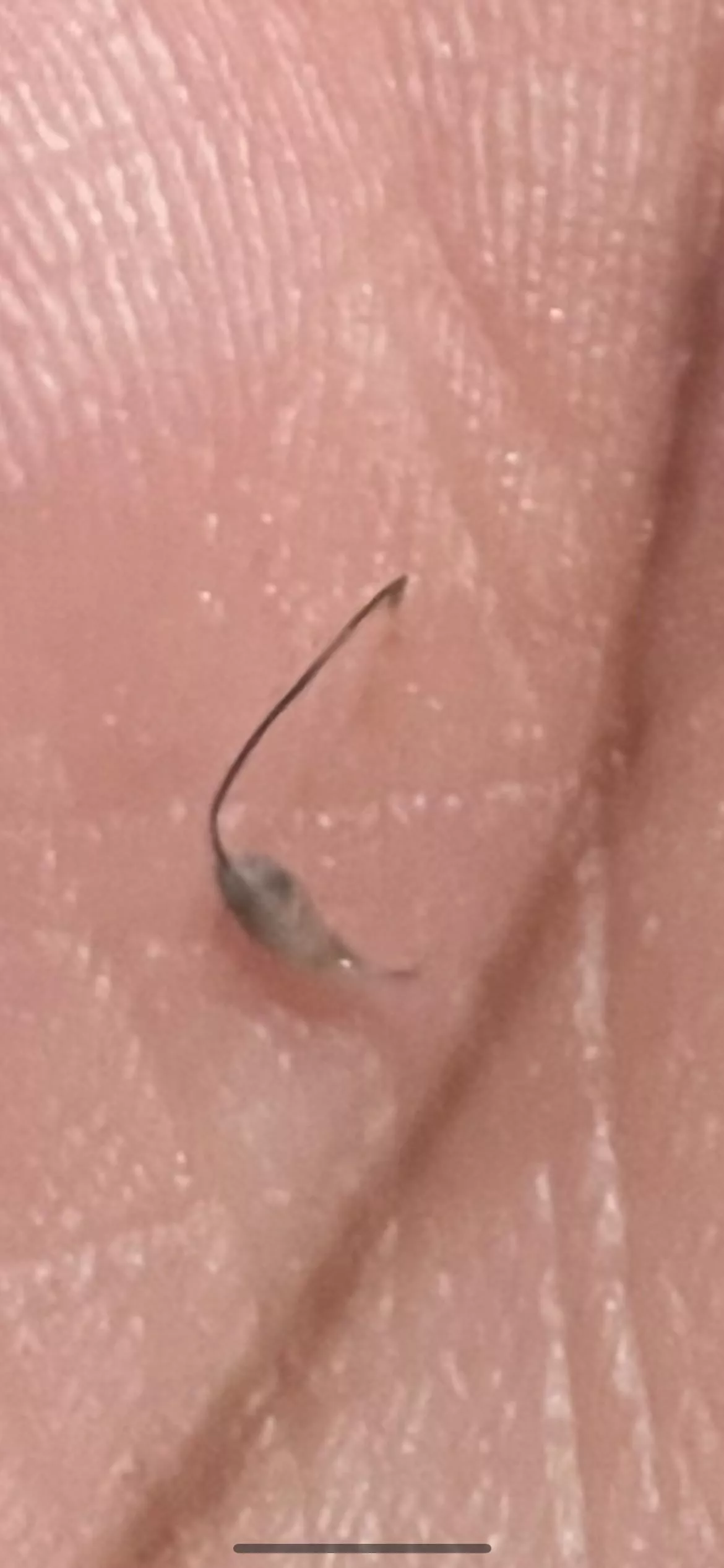 Ingrown/cyst?? Idk..