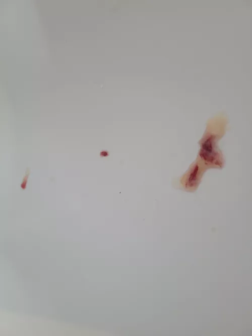 Long time Lurker, first time poster