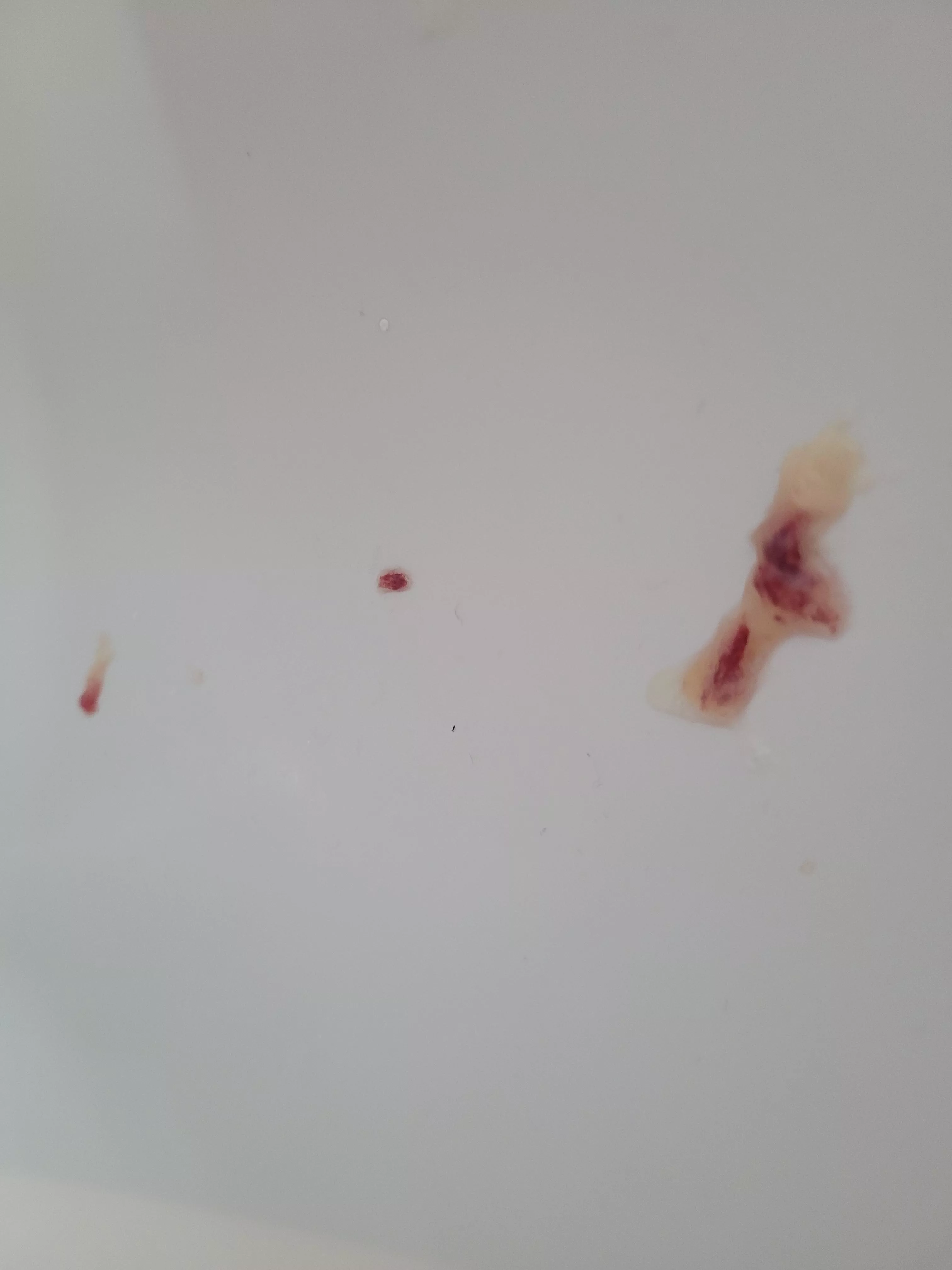 Long time Lurker, first time poster