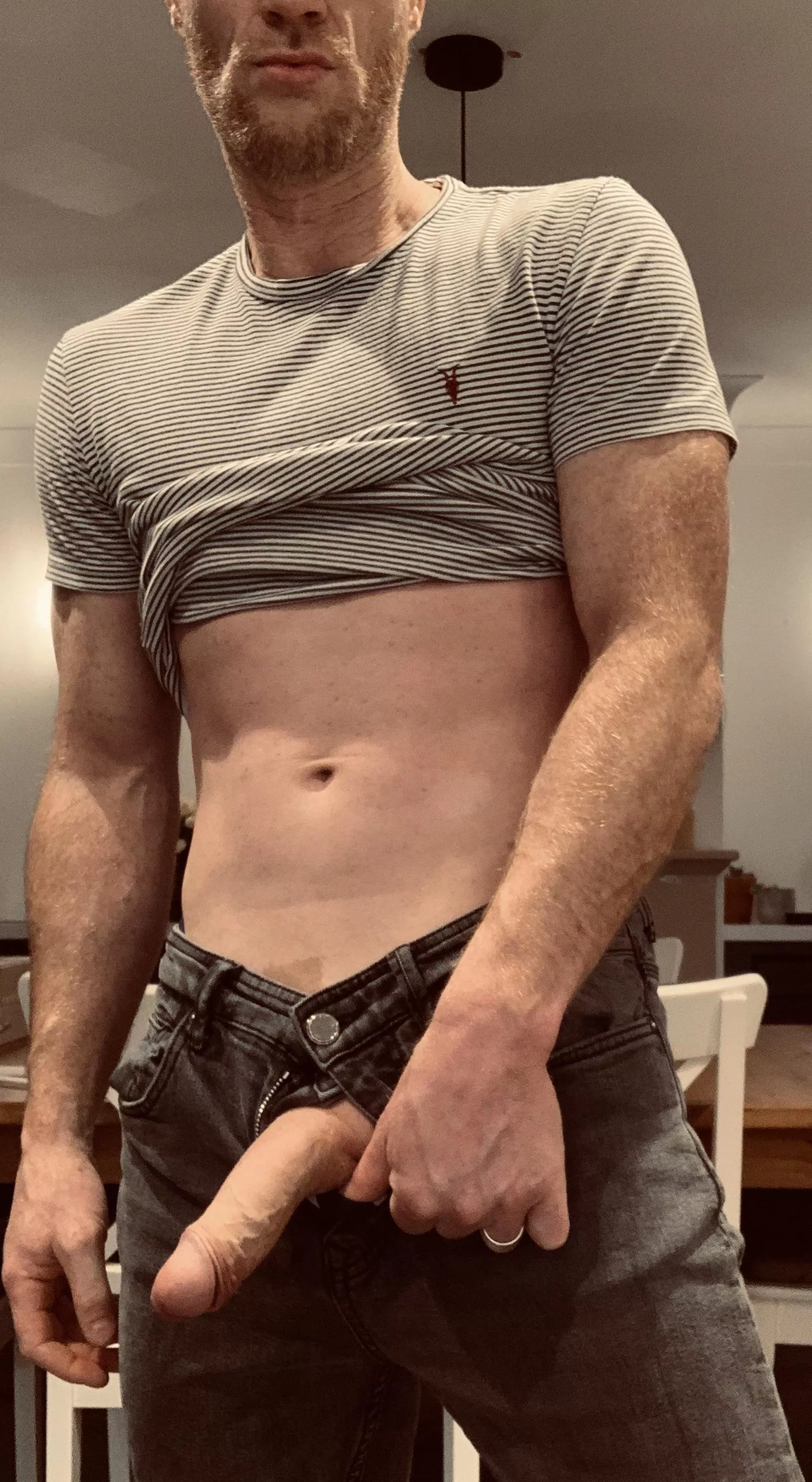 Dad [44] more freckles than a leopard 🐆