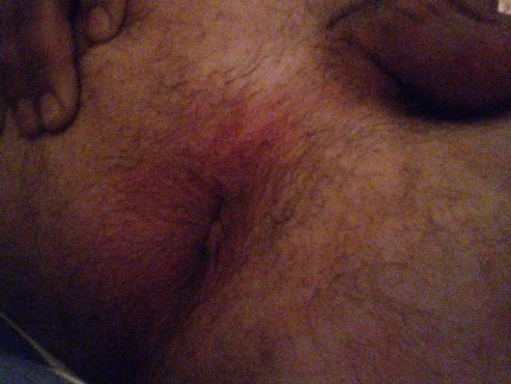 My hairy hole