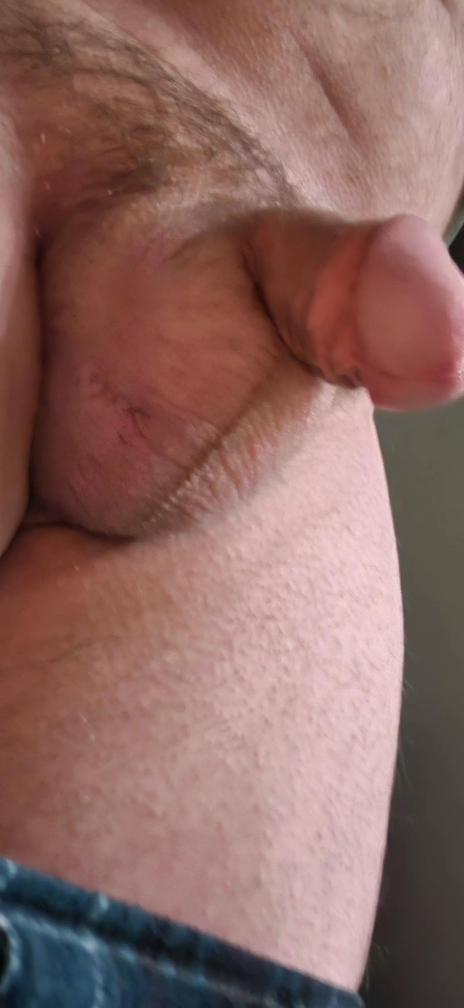 My small, hairy softie. I'd shave but I don't need another scar or deep cut.