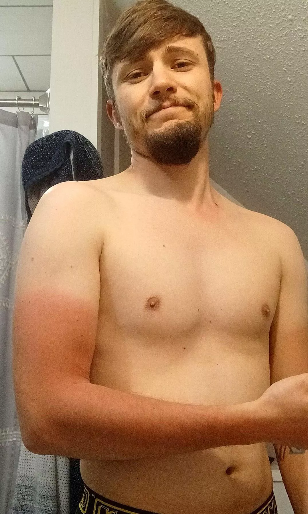 Friendly reminder to wear sunscreen. 🦞 Friendly reminder to wear sunscreen. 🦞