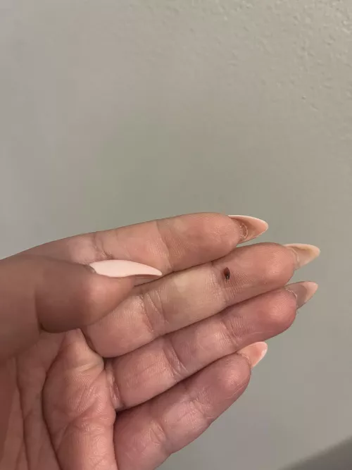 Got his out of my scalp