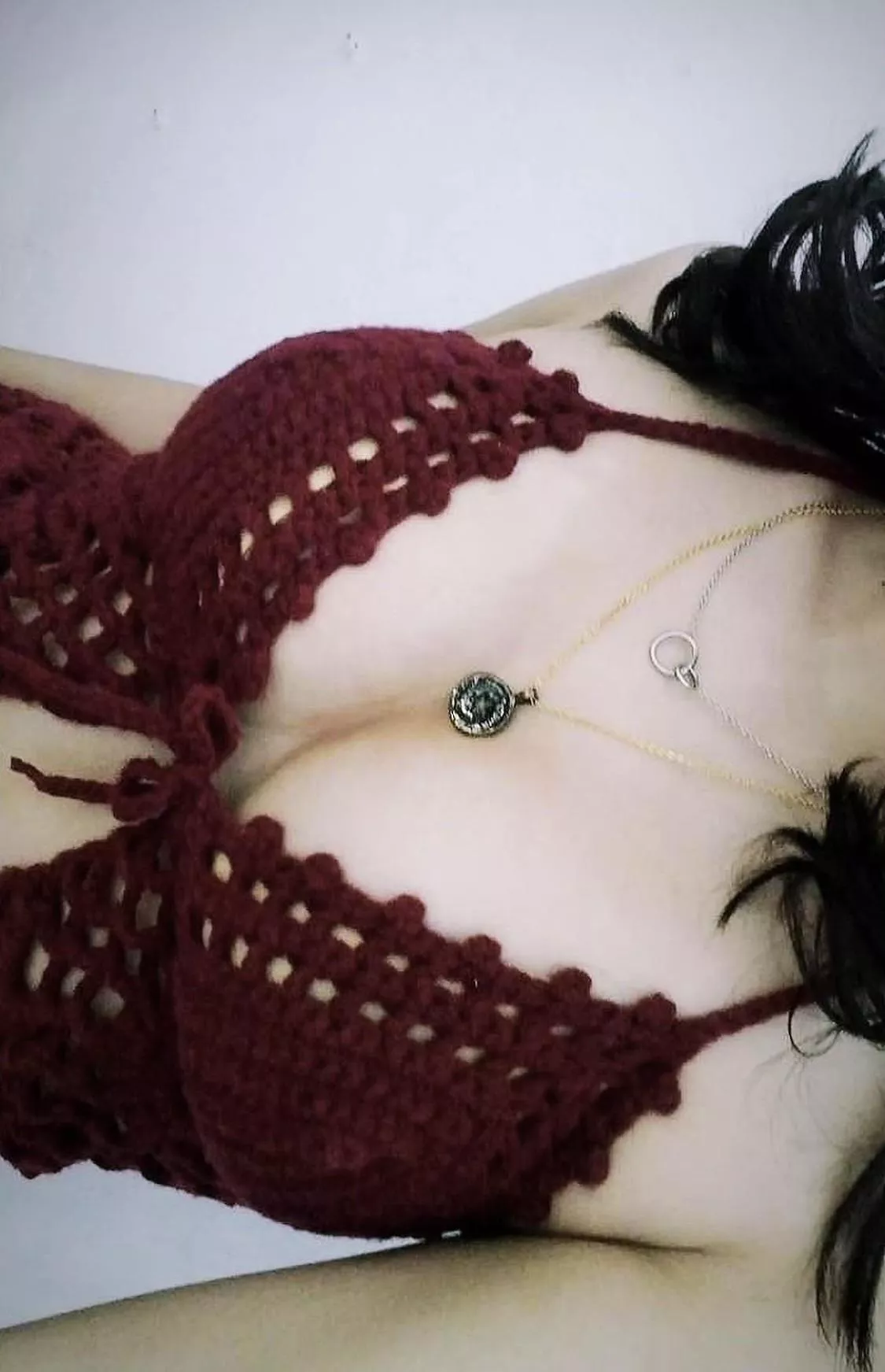 A month of high dose of estrogen with testosterone blockers results this....