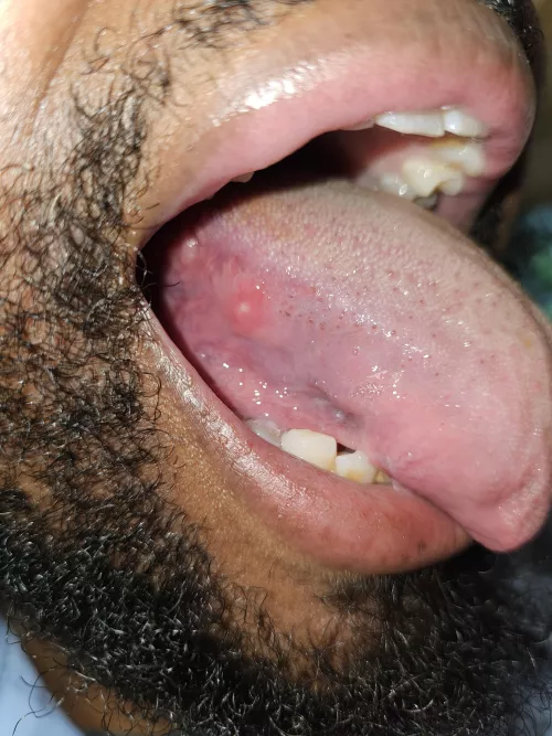 First time this has happened