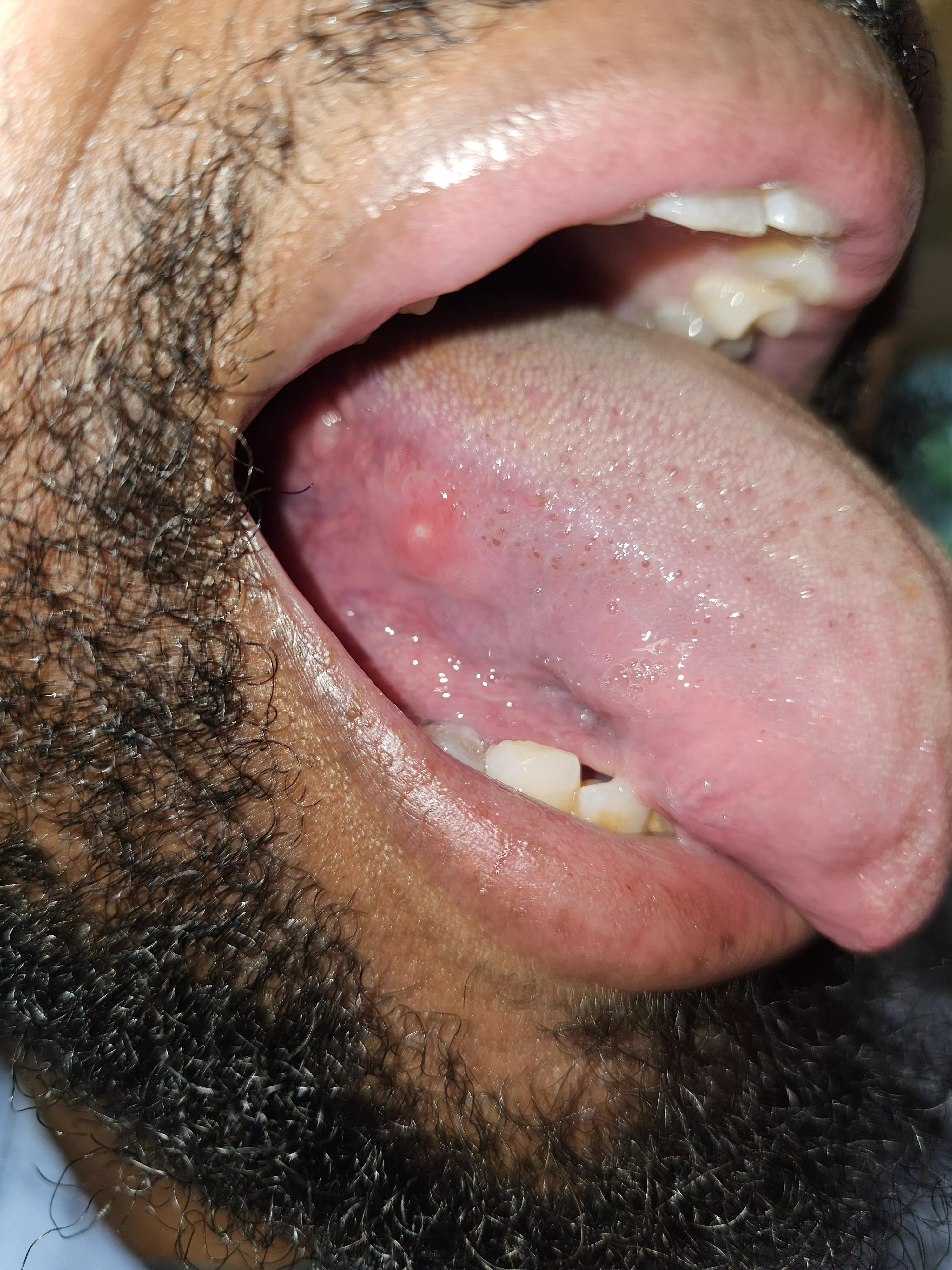 First time this has happened