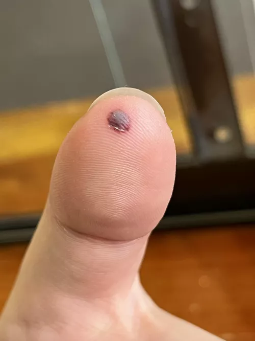 Forbidden! There’s so much pressure I want to pop it.