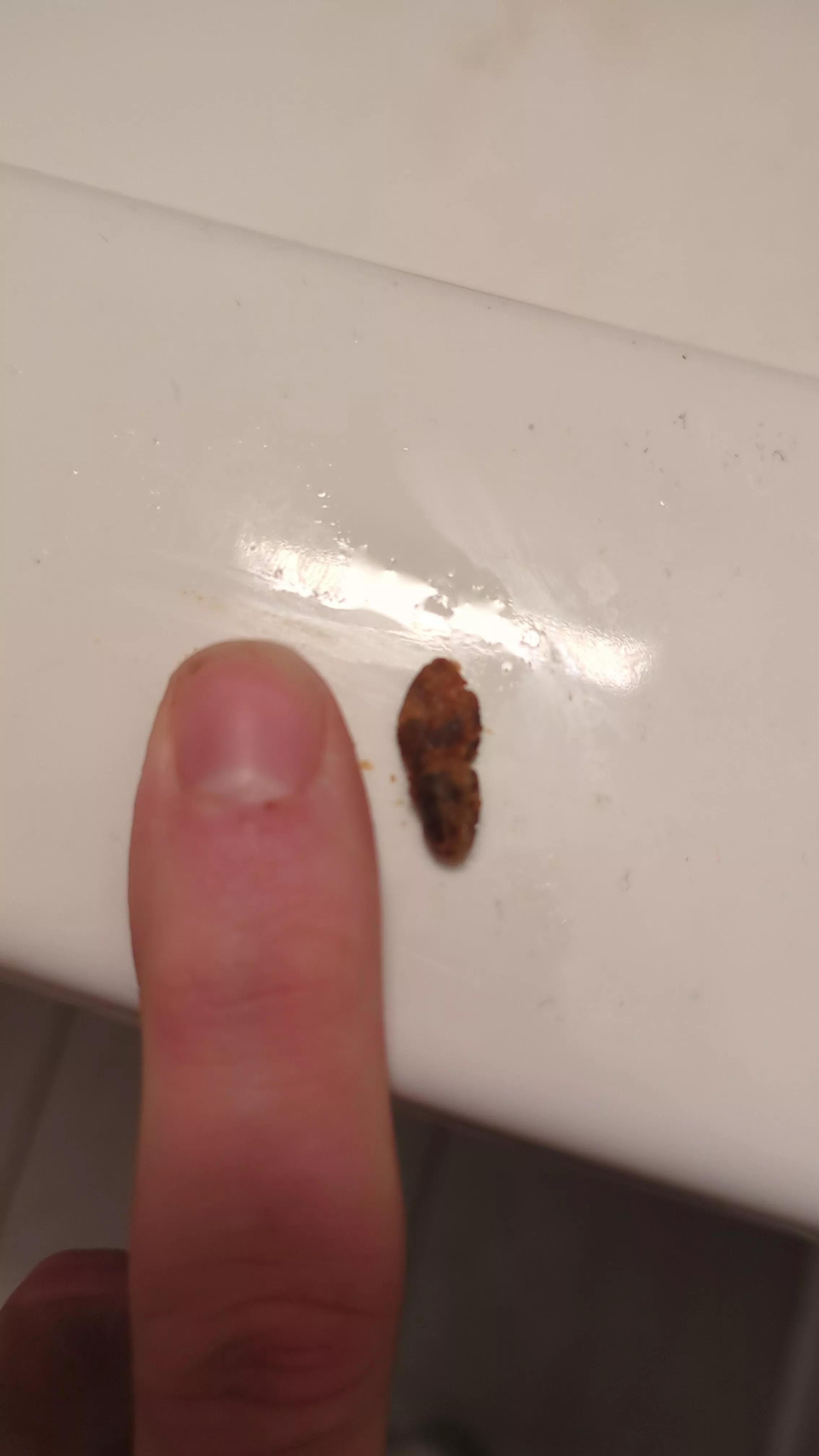 Just had the nastiest impacted earwax of my life