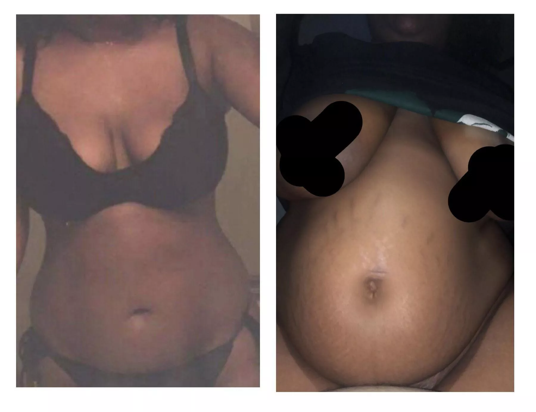 Mesmerized by how wide my belly button got 🙄 Im also now covered in stretchies 😬