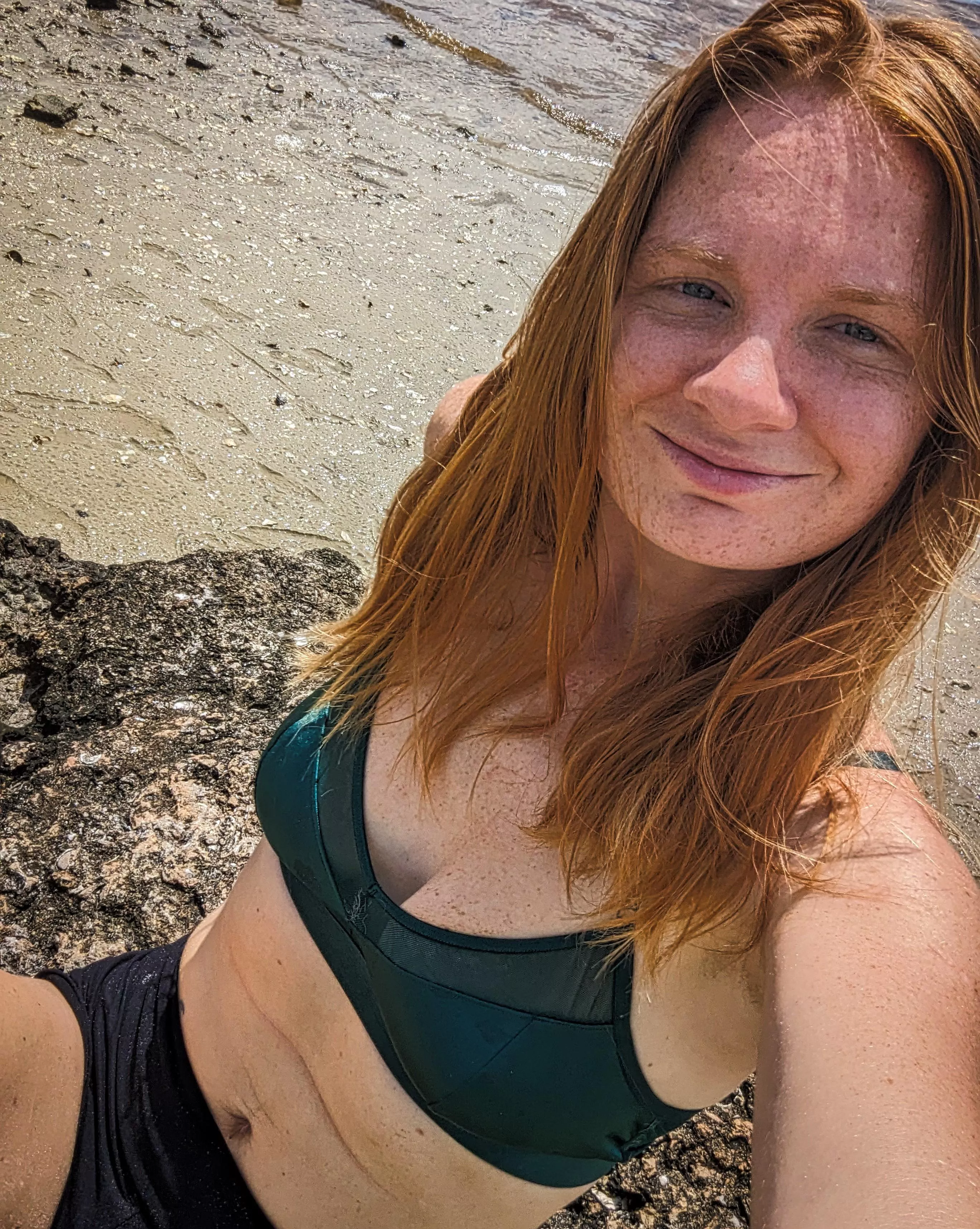 Fiery and freckled fantasy