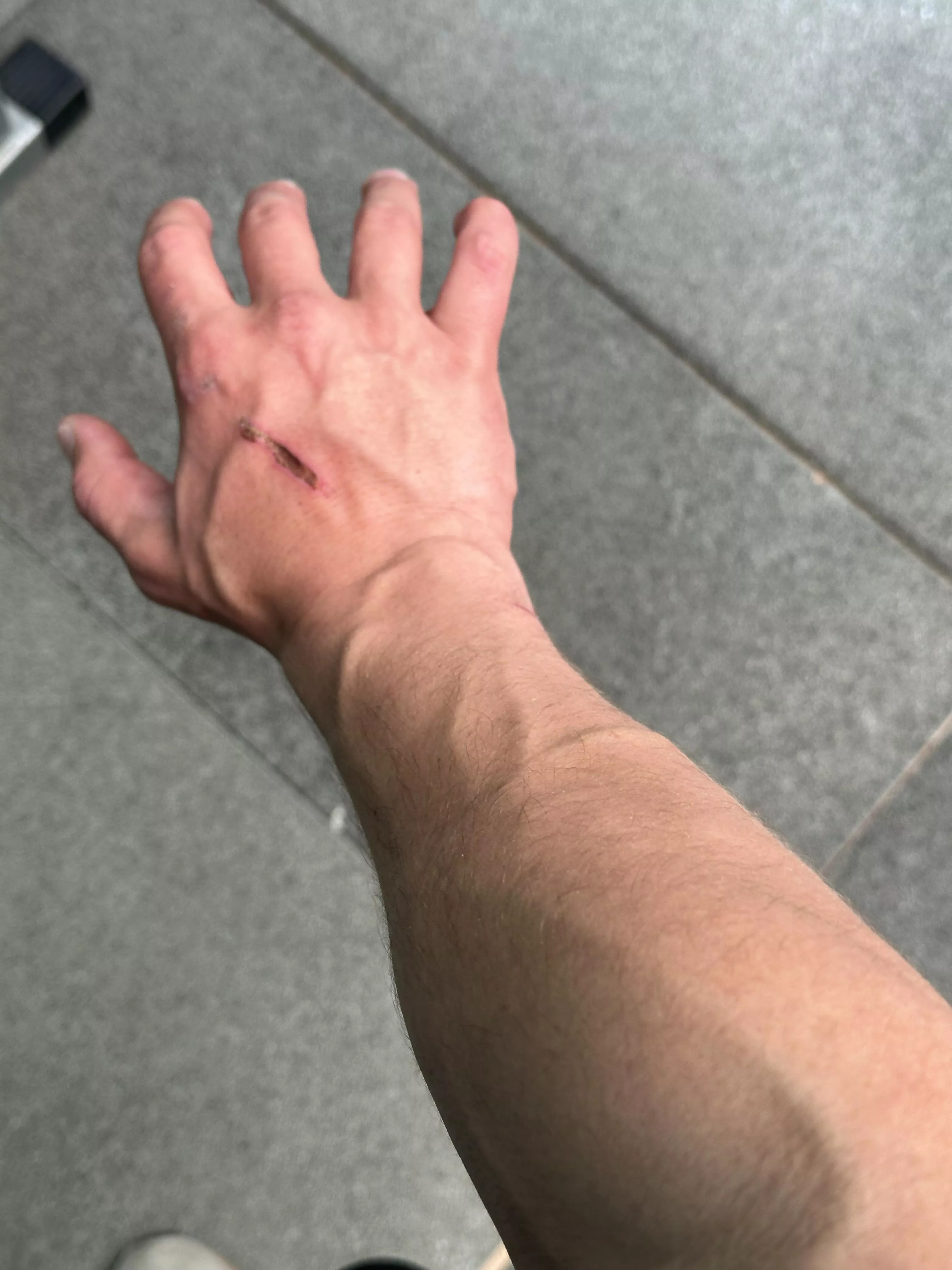 Veiny and injured