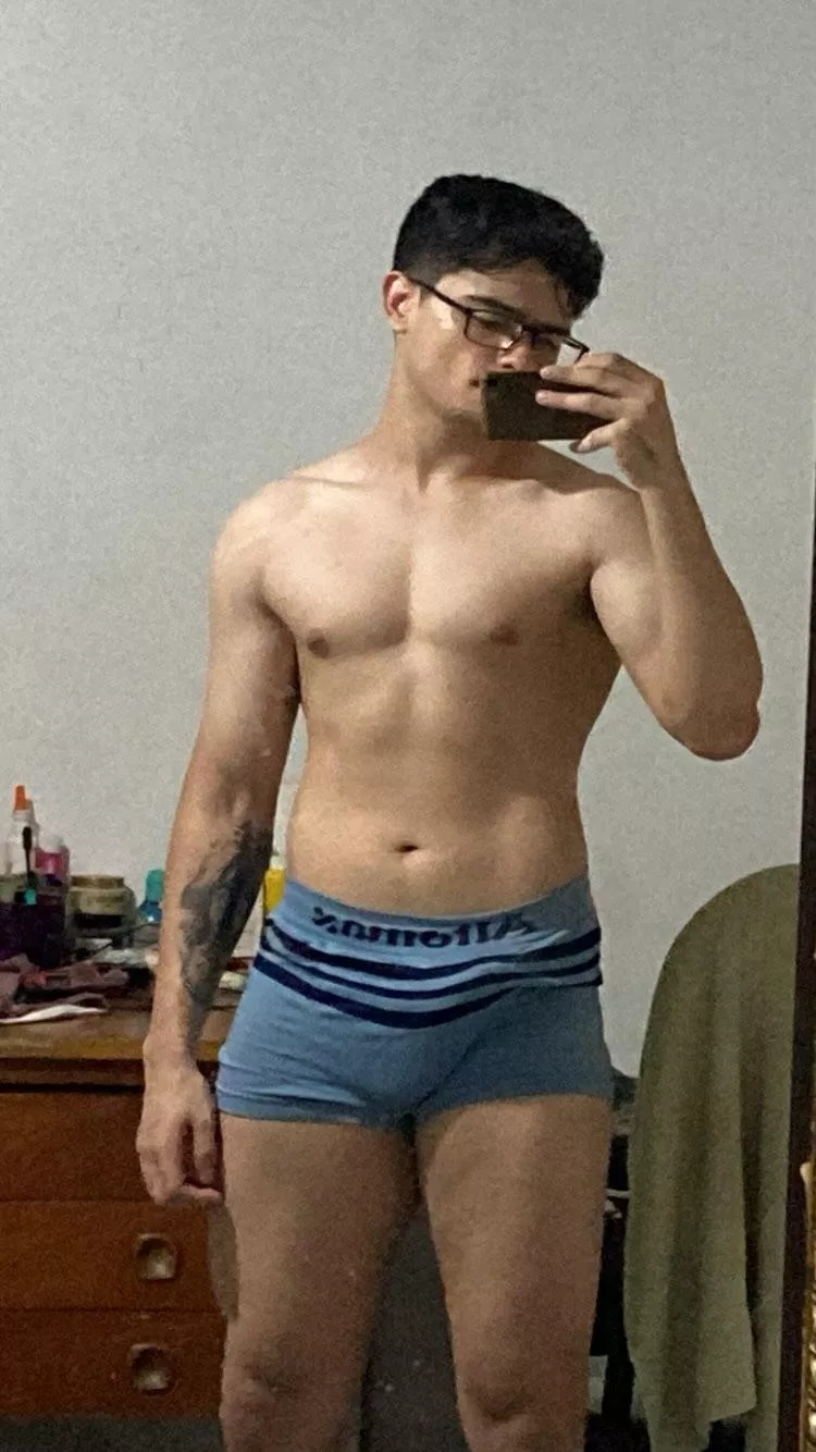 It doesnt look like but my arm is in pain [M]