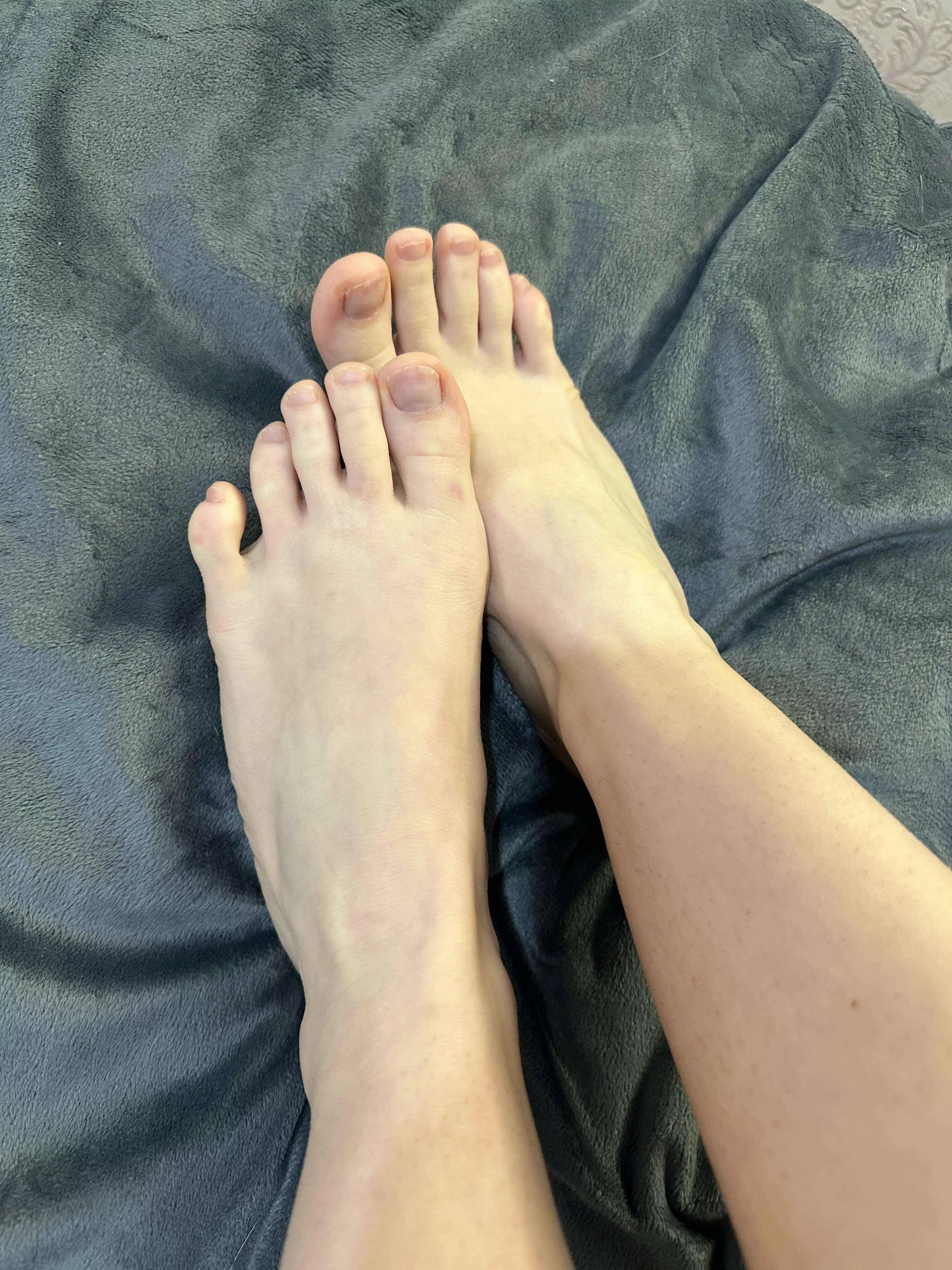 My ex-boyfriend considered my toes not the best