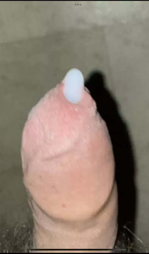 When edging goes too far