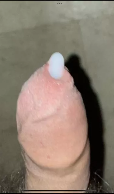 When edging goes too far