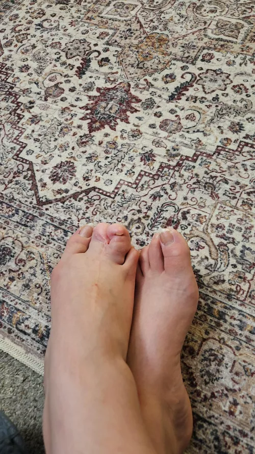 Deformed foot. Could I make money off my foot? 