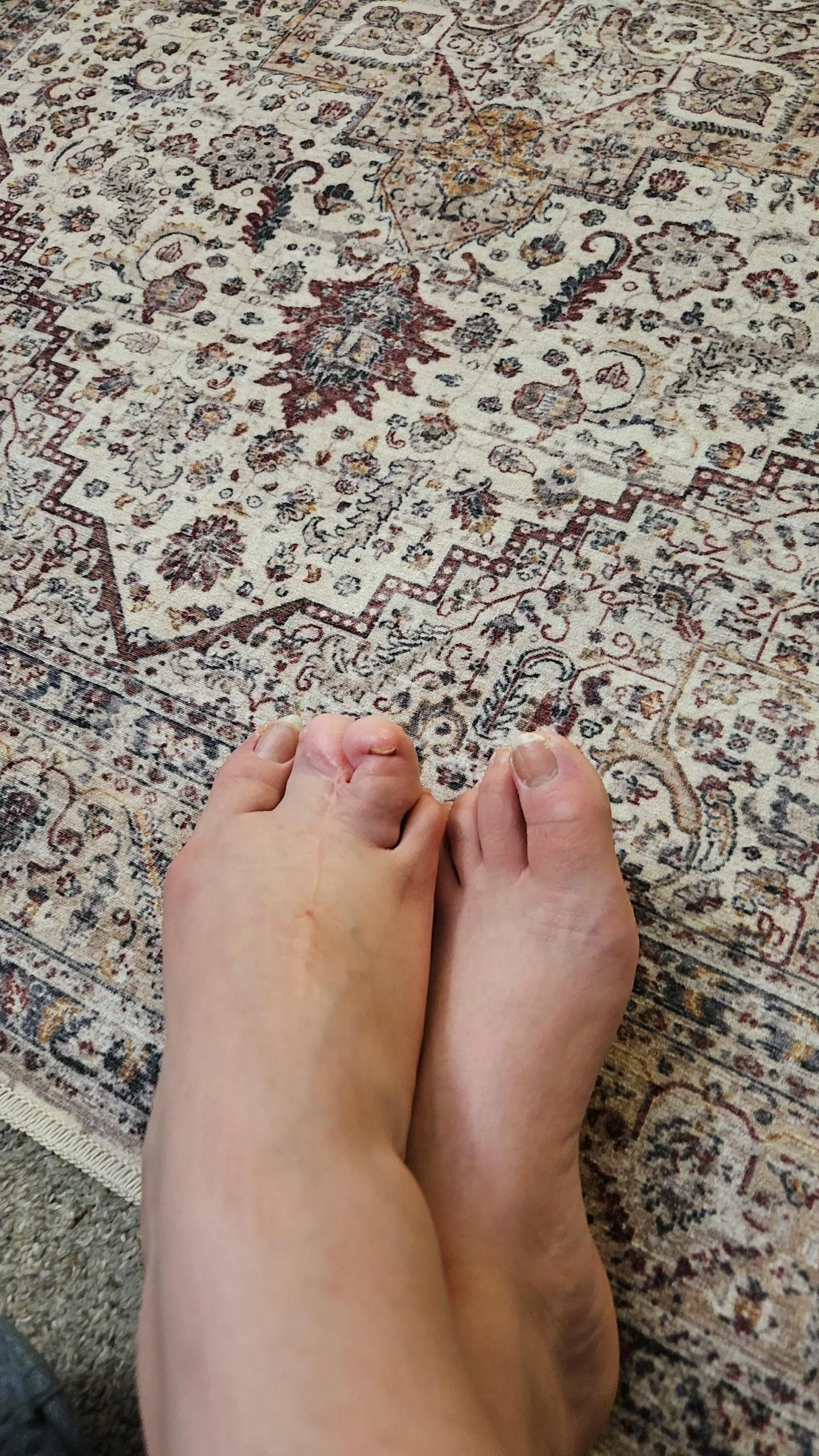 Deformed foot. Could I make money off my foot? 