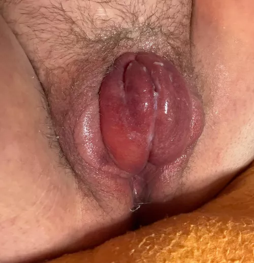 Had to pump this cunt up 😉 [f] such a beautiful destroyed pussy. 