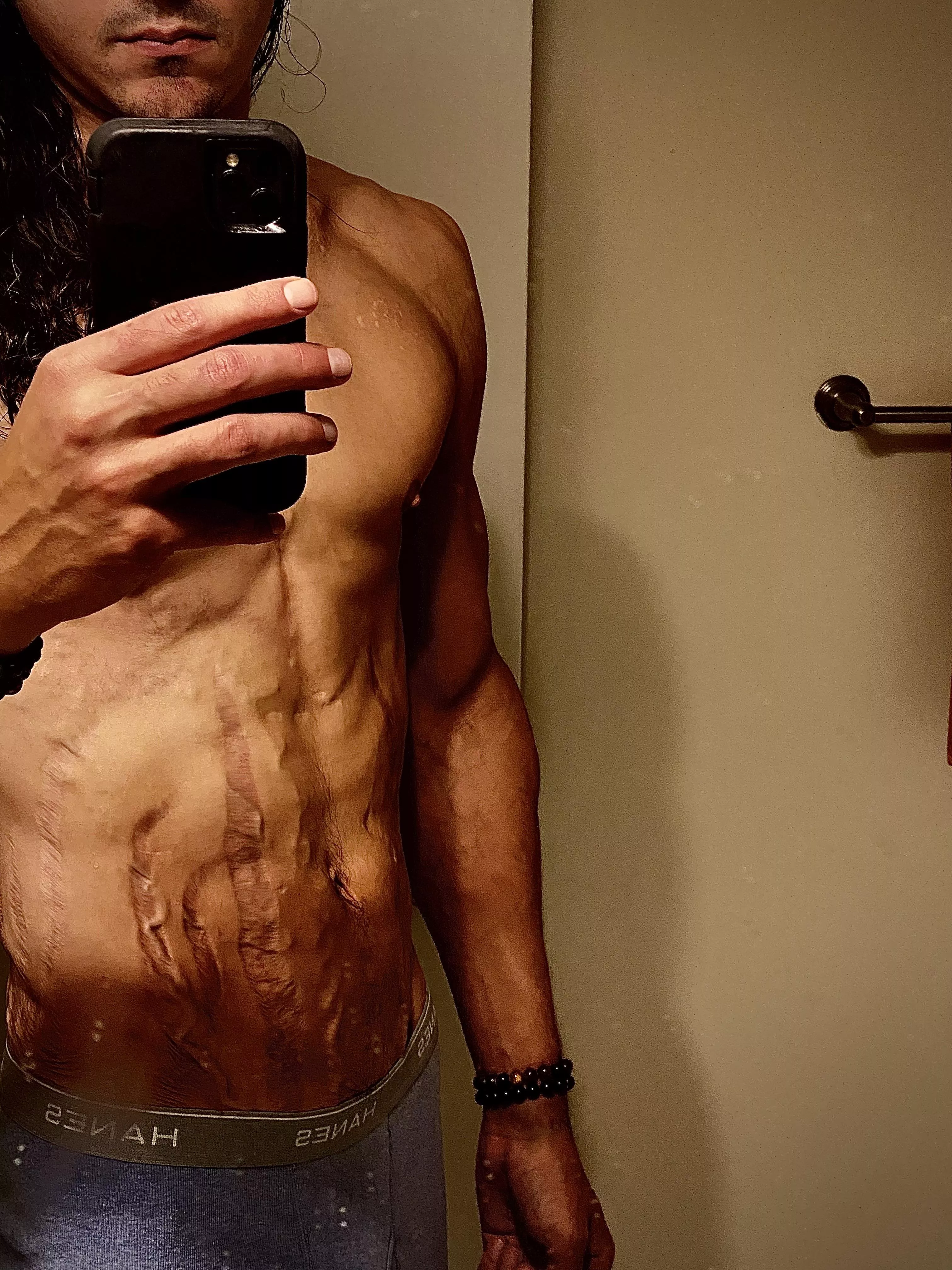 Anyone like scars?