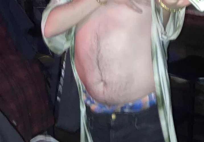 Boxers peeking through