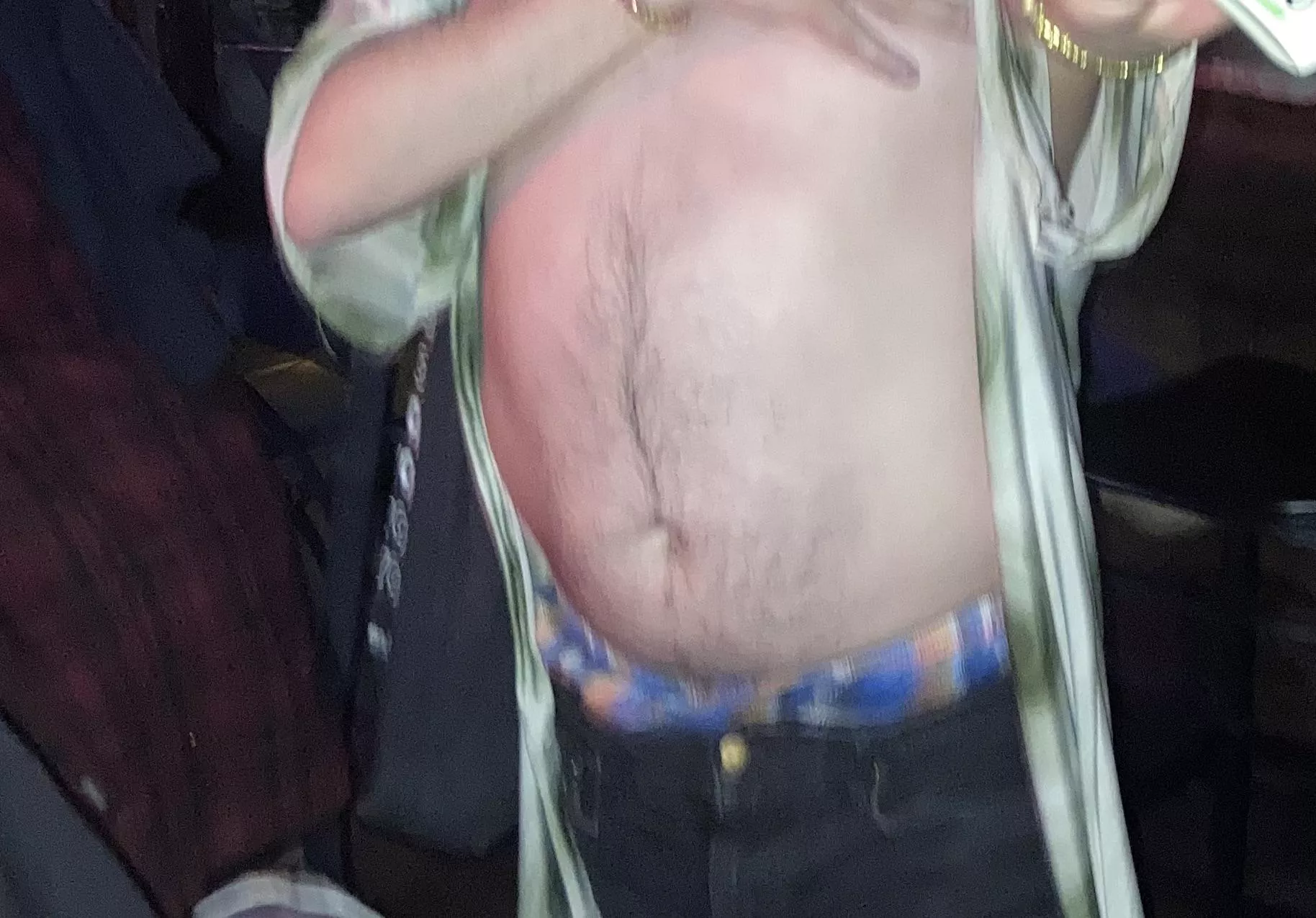 Boxers peeking through