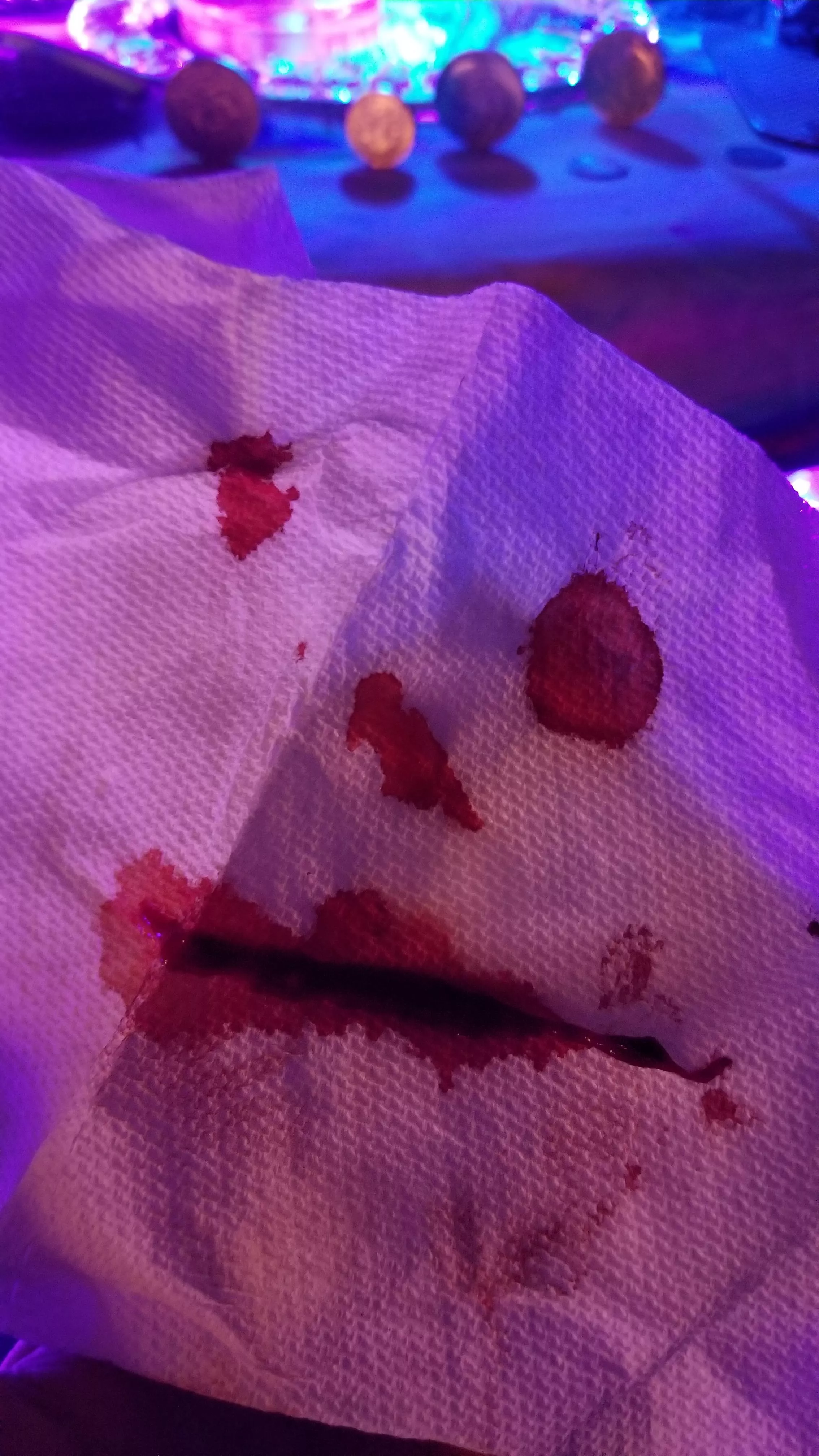 Just had a nose bleed and I unexpectedly made a very scary bloody clown face on my tissue