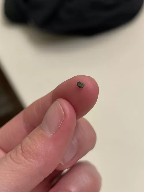 Black chunk squeezed out of ear piercing hole