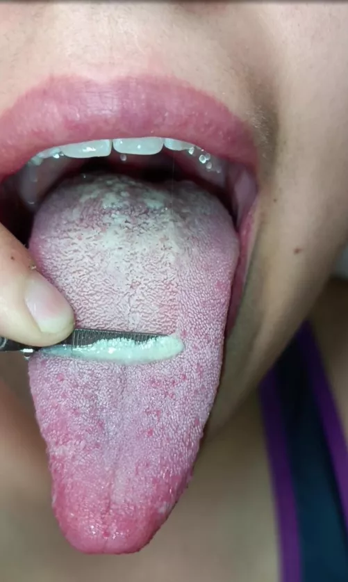 I'm scraping some white spit for ya