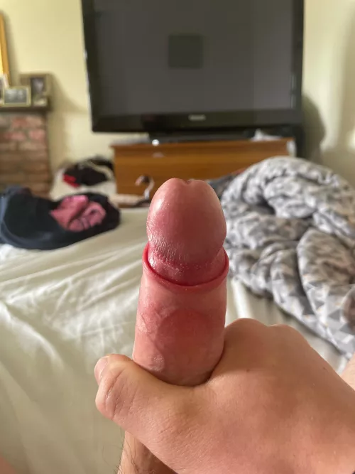 Should my foreskin look like that