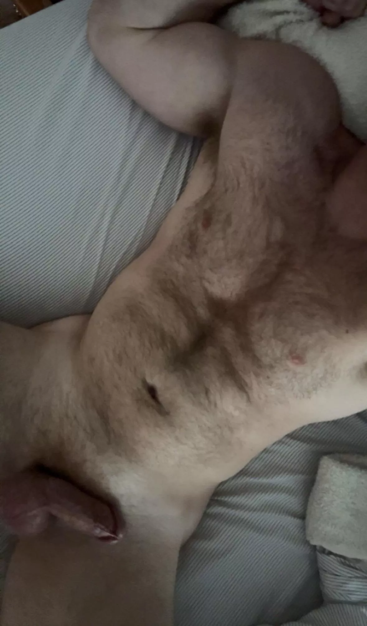 Verbal hairy muscle dm with pic for snap