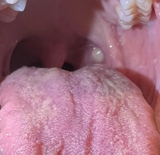 What is this in the back of my throat?