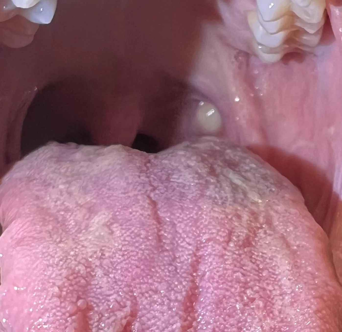What is this in the back of my throat?