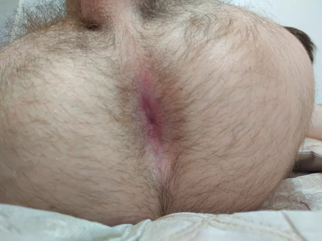 What would you do to that hole?