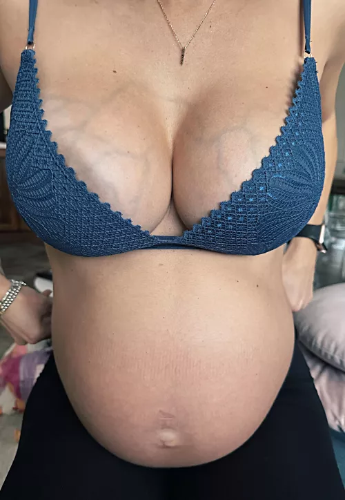 Where do the veins lead?🤔