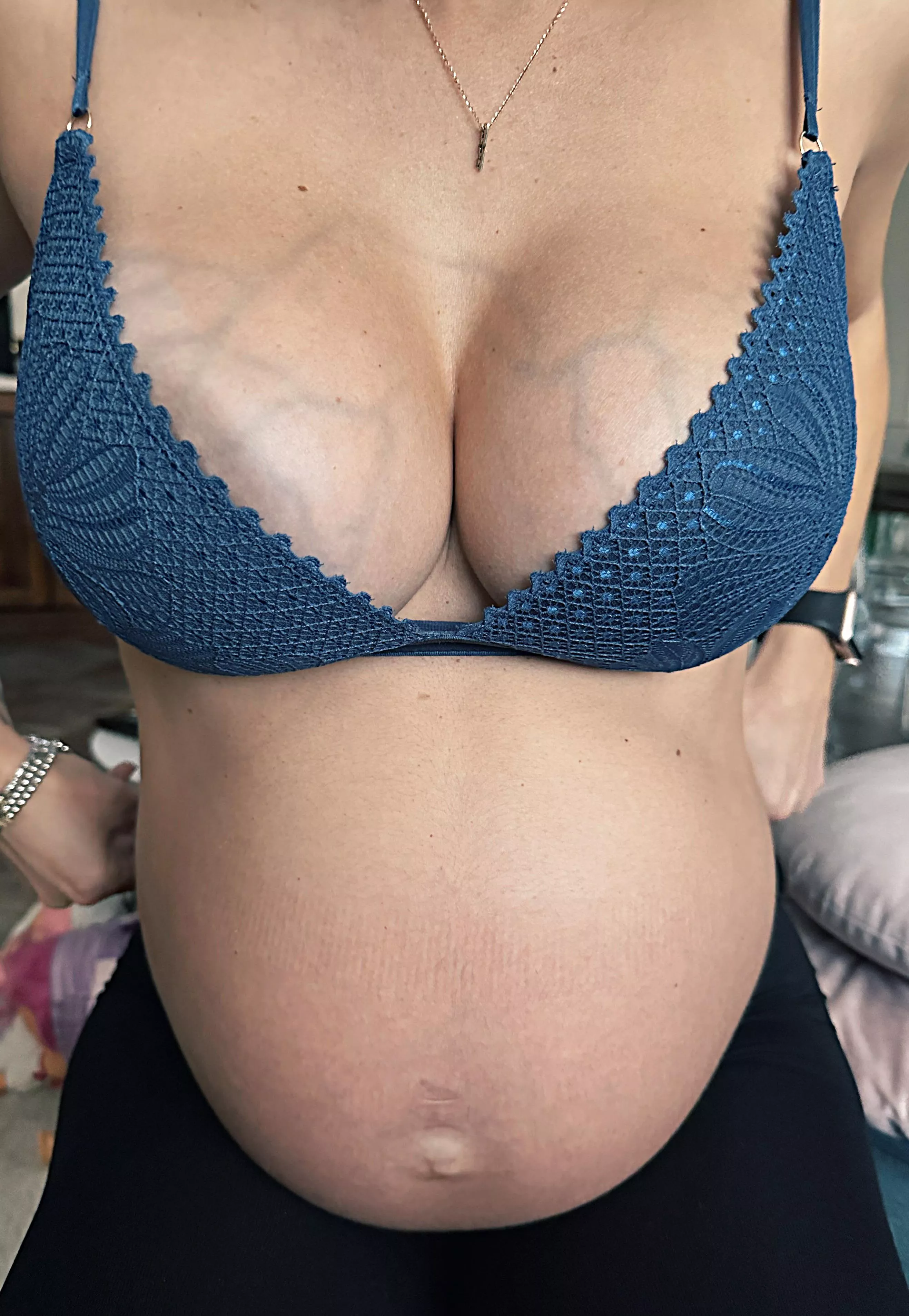 Where do the veins lead?🤔