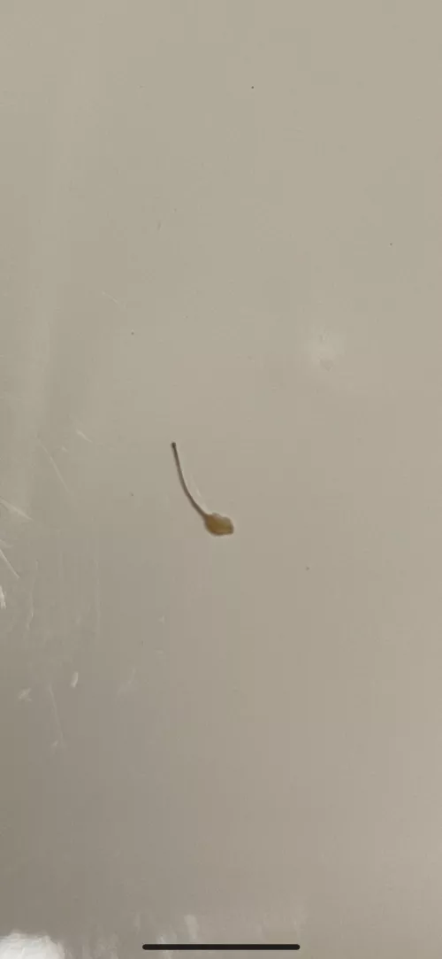 Ingrown hair after wax 