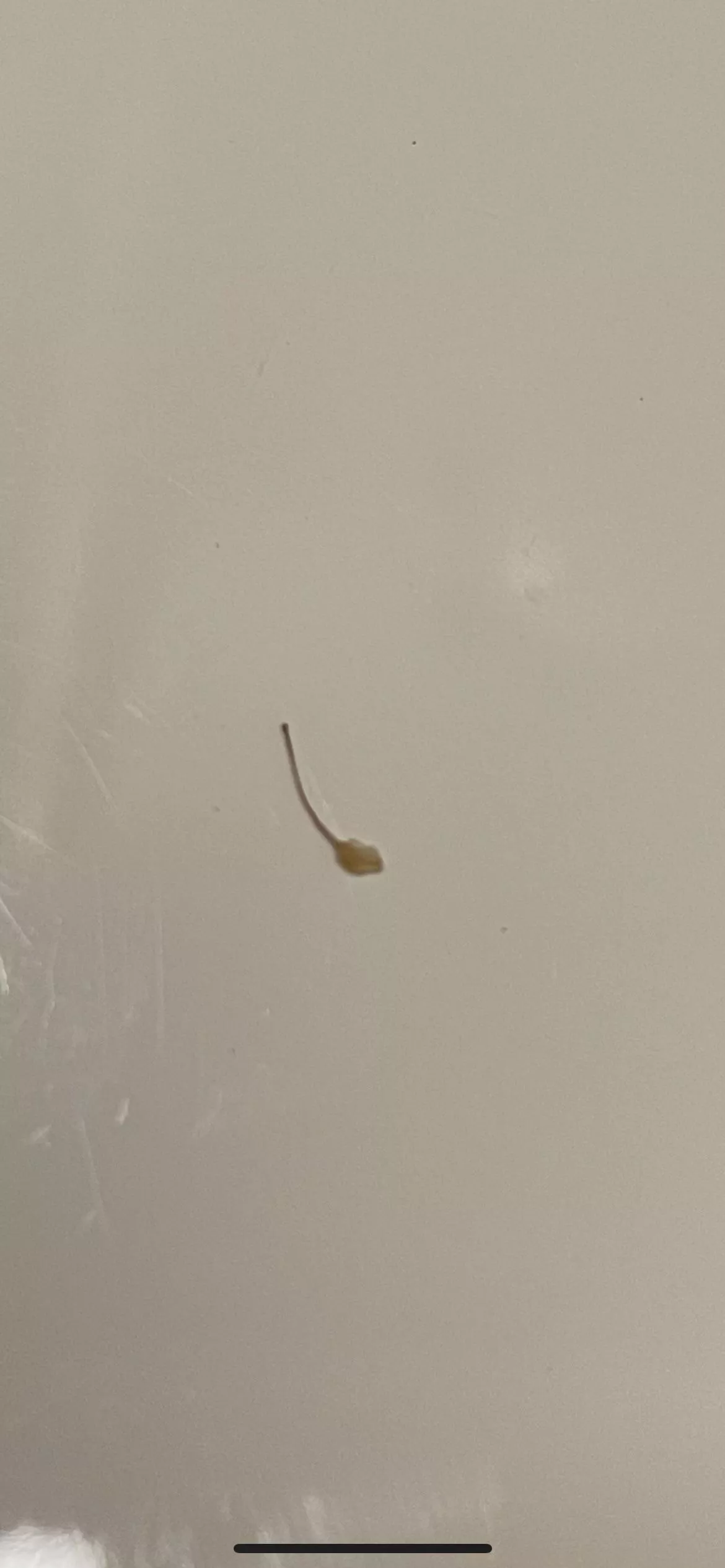 Ingrown hair after wax 