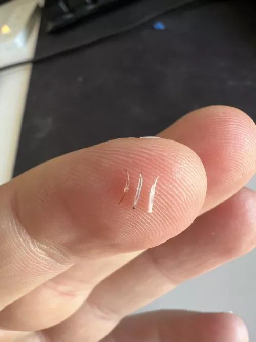 Normal hair vs painful hairs