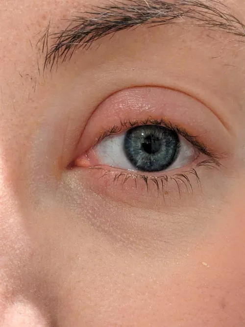 Who else loves styes? :D