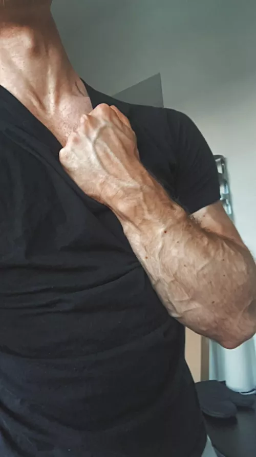 Felt vascular, might delete later
