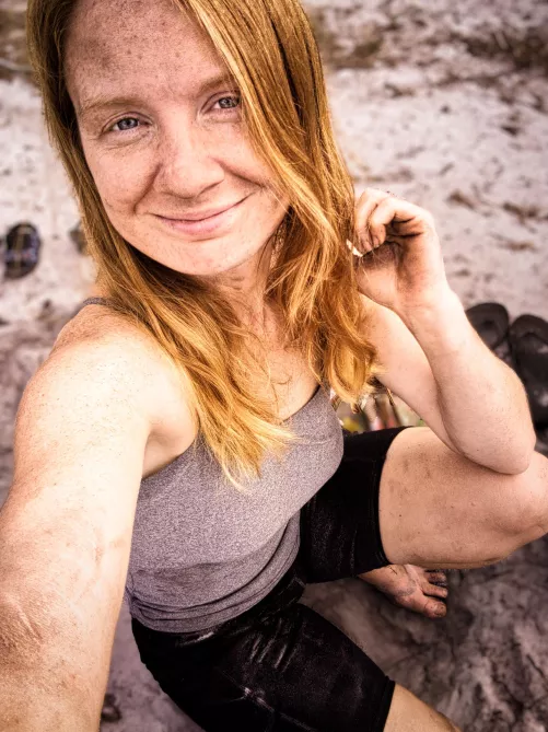 Freckles and fun untold stories revealed