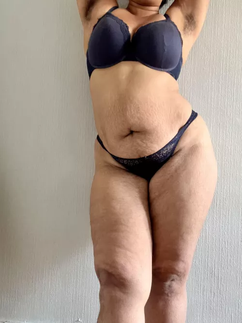 Hairy all over, pick your poison...