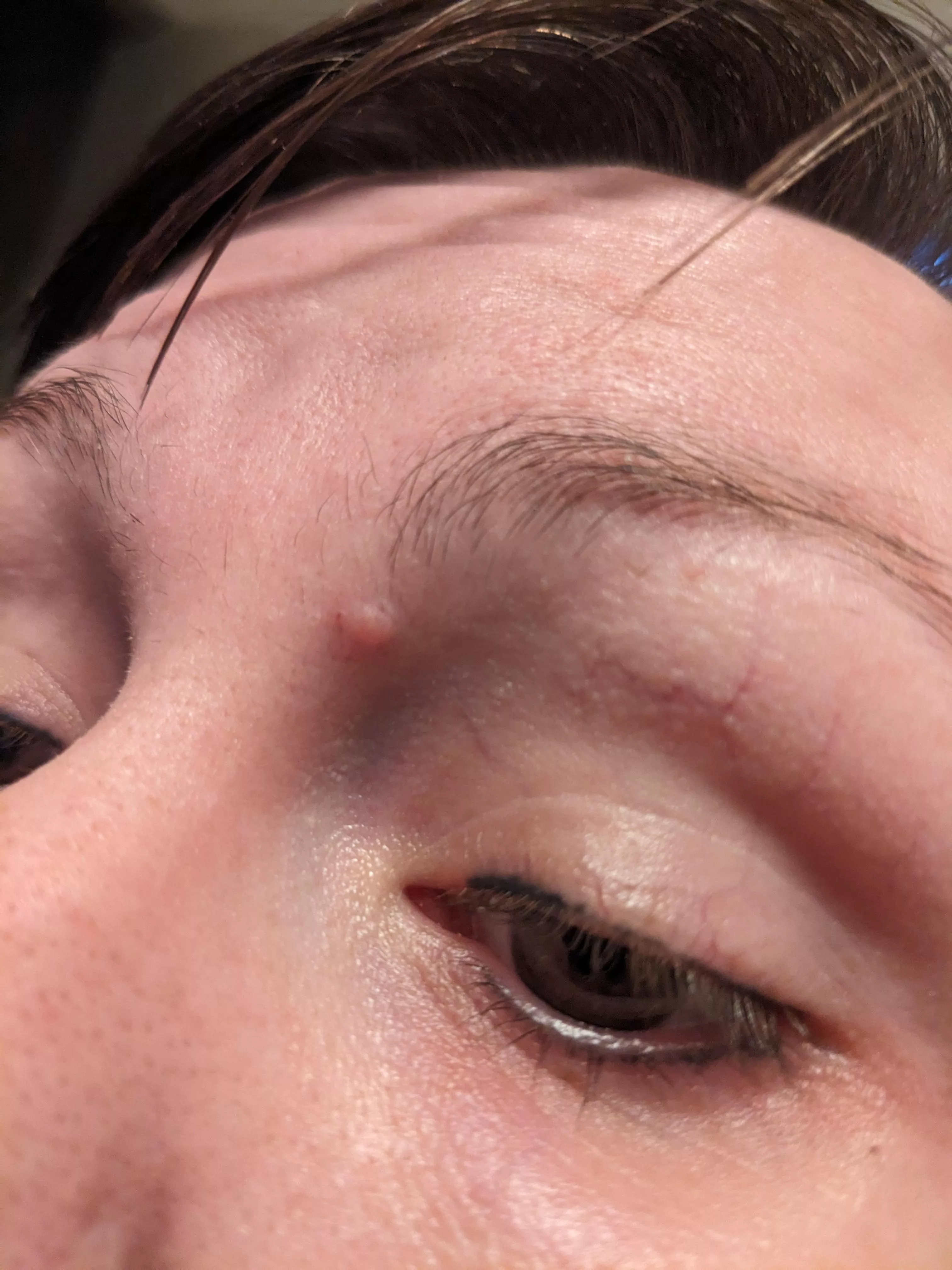 Honestly I'm on the verge of taking a razor blade to this thing