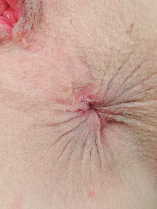 I hope you like it served RARE