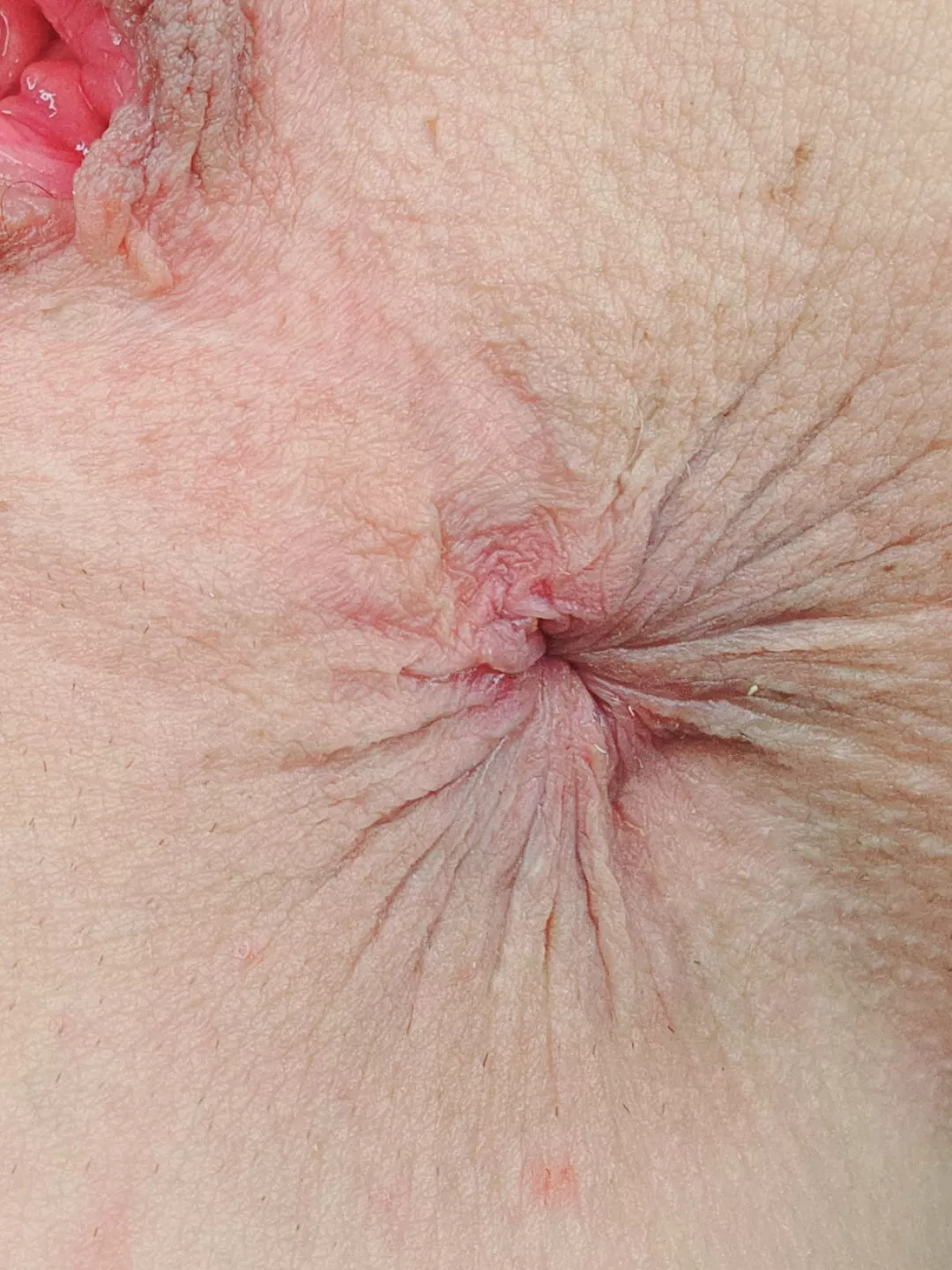 I hope you like it served RARE