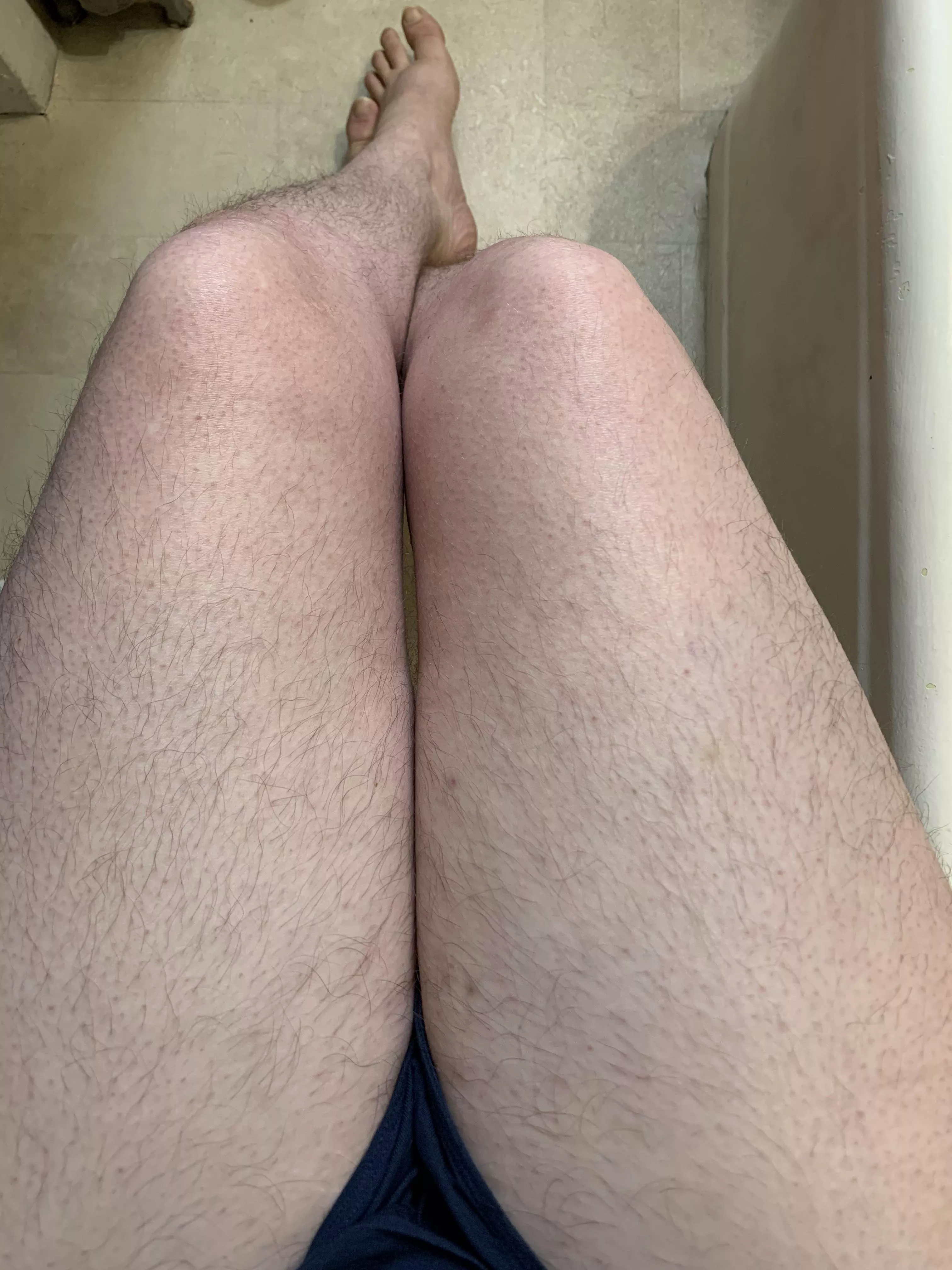 Pretty [h]airy all over