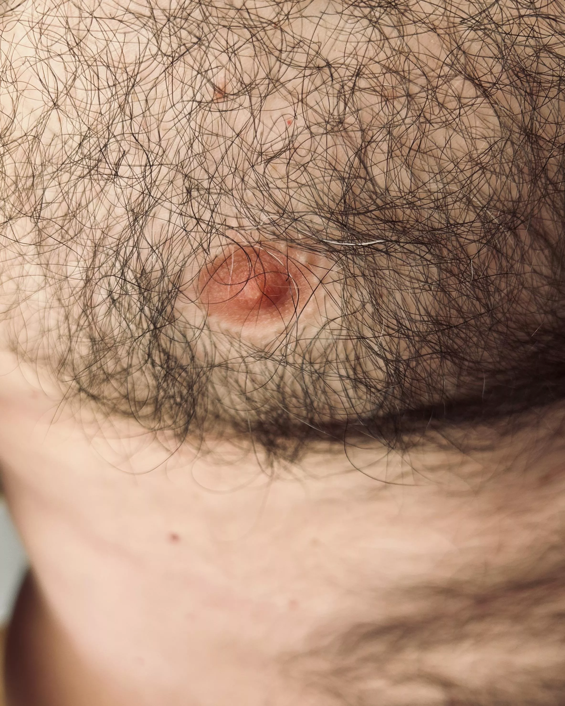 Everytime I sneeze, my tiny nipples get rock hard.